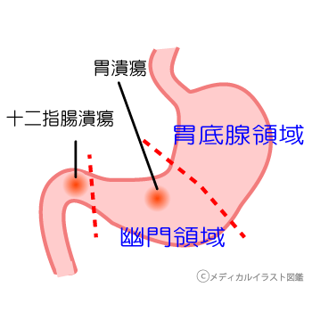 胃です