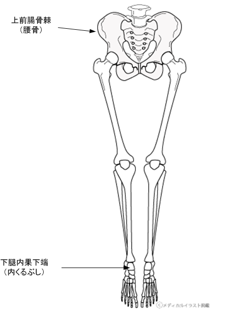 下肢短縮